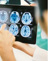 Brain Tumor Diagnostics Market by Type and Geography - Forecast and Analysis 2022-2026