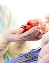 Hemostasis Valve Market by Application and Geography - Forecast and Analysis 2022-2026