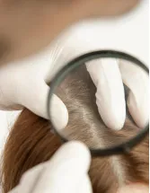 Lice Treatment Market by Distribution Channel and Geography - Forecast and Analysis 2022-2026