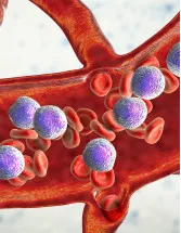 APAC Acute Myeloid Leukemia (AML) Treatment Market by Type and Geography - Forecast and Analysis 2022-2026