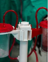Autotransfusion Systems Market by Type and Geography - Forecast and Analysis 2022-2026