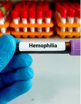 Rare Hemophilia Factors Market by Method and Geography - Forecast and Analysis 2022-2026