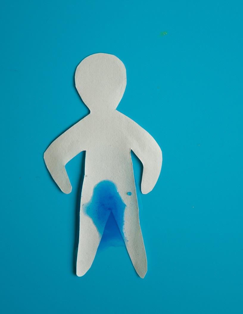 Urinary Incontinence Devices Market Analysis, Size, and Forecast 2024-2028: North America (US and Canada), Europe (Germany and UK), APAC (China), and Rest of World (ROW)