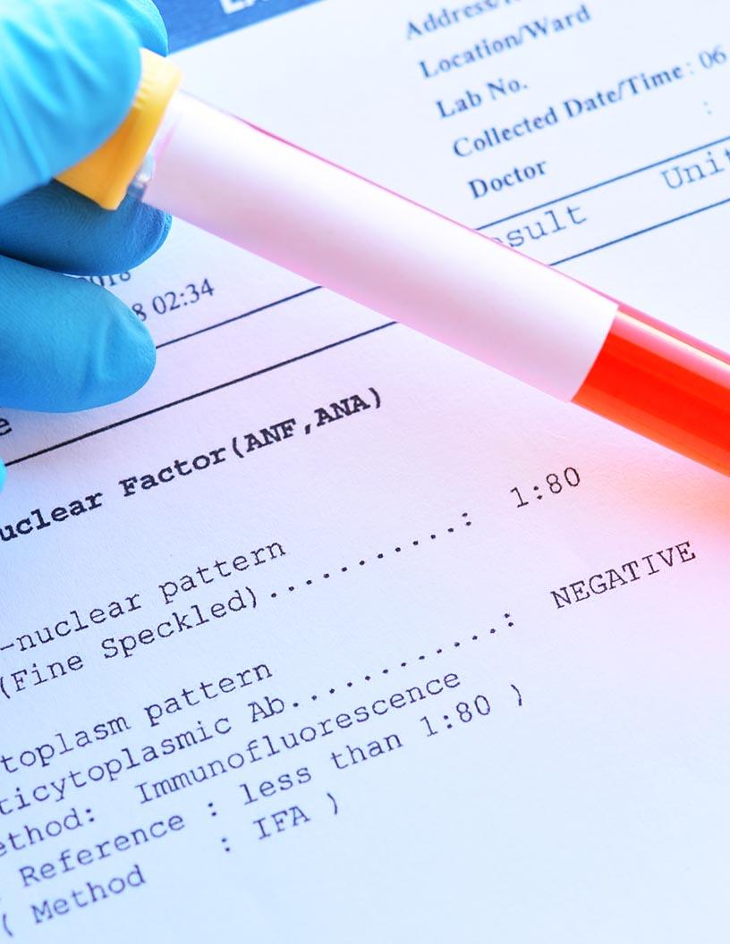 Antinuclear Antibody Test Market Analysis, Size, and Forecast 2025-2029: North America (US, Canada, and Mexico), Europe (France, Germany, Italy, and UK), APAC (China and Japan), South America (Brazil), and Rest of World (ROW)