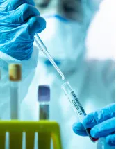 Arbovirus Testing Market by End-user and Geography - Forecast and Analysis 2022-2026