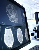 Neurodegenerative Diseases Therapeutics Market by Indication and Geography - Forecast and Analysis 2022-2026