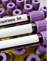 Breast Cancer Liquid Biopsy Market by Product Type and Geography - Forecast and Analysis 2022-2026