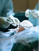 Cruciate Ligament Repair Procedures Market by Type and Geography - Forecast and Analysis 2022-2026