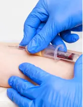 Venous Blood Collection Market by Application and Geography - Forecast and Analysis 2022-2026