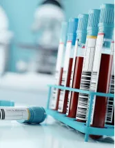 Hemocytometer Market by End-user and Geography - Forecast and Analysis 2022-2026