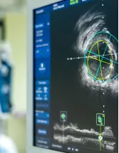 Cardiovascular Ultrasound Imaging Systems Market by Product and Geography - Forecast and Analysis 2022-2026