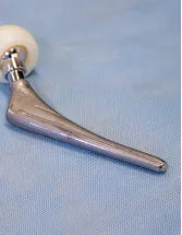 Femoral Head Prostheses Market by Material and Geography - Forecast and Analysis 2022-2026