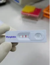 Myoglobin Market by Type and Geography - Forecast and Analysis 2022-2026