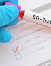 Sexually Transmitted Diseases (STD) Treatment Market by Service and Geography - Forecast and Analysis 2022-2026