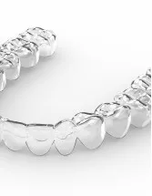 Dental Braces Market by Material, Product, and Geography - Forecast and Analysis 2023-2027