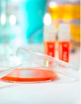 Transfection Technologies Market Research Report, Size , Growth, Trends, Opportunity Analysis, Industry Forecast - 2022-2026