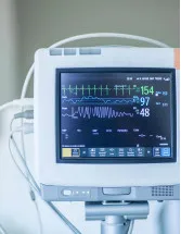 Diagnostic Electrocardiograph (ECG) Market Analysis North America, Europe, Asia, Rest of World (ROW) - US, Canada, Germany, UK, China - Size and Forecast 2024-2028