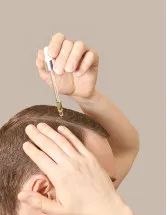 Hair Loss Treatment Products Market by Product Type, Gender, and Geography - Forecast and Analysis 2023-2027