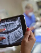 Dental X Ray Market Analysis North America, Europe, Asia, Rest of World (ROW) - US, Canada, Germany, Japan, China - Size and Forecast 2023-2027