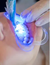 Dental Curing Lights Market Analysis North America, Europe, APAC, South America, Middle East and Africa - US, China, Japan, Germany, France - Size and Forecast 2023-2027