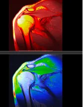 Contrast Media Market by Modality, Application, and Geography - Forecast and Analysis 2023-2027