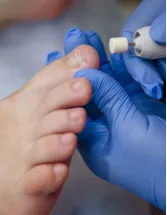 Onychomycosis Treatment Market by Type, Distribution Channel, and Geography - Forecast and Analysis 2023-2027