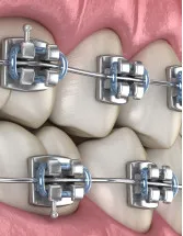 US - Dental Chains Market by Revenue Stream - Forecast and Analysis 2023-2027