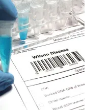 Wilsons Disease (WD) Drugs Market by Product, Distribution Channel, and Geography - Forecast and Analysis - 2023-2027