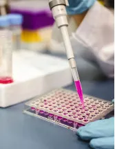 Oncology Molecular Diagnostics Market by Product, Type and Geography - Forecast and Analysis 2023-2027