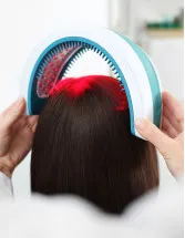 Laser Hair Loss Treatment Market by Gender, Type, and Geography - Forecast and Analysis - 2023-2027