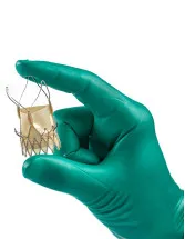 Transcatheter Aortic Valve Replacement (TAVR) Market Analysis North America, Europe, EMEA, APAC : US, Canada, China, Germany, UK - Size and Forecast 2023-2027