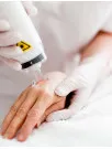Dermatology Lasers Market Analysis North America, Europe, Asia, Rest of World (ROW) - US, Germany, UK, China, India - Size and Forecast 2024-2028