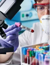Hematology Analyzers and Reagents Market Analysis North America, Asia, Europe, Rest of World (ROW) - US, Canada, Germany, China, Japan - Size and Forecast 2024-2028