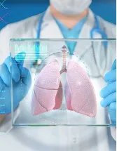Liver Cirrhosis Therapeutics Market Analysis North America, Europe, Asia, Rest of World (ROW) - US, Germany, UK, Japan, China - Size and Forecast 2024-2028