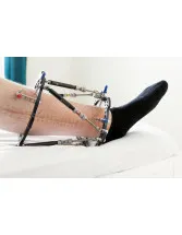 Orthopedic Trauma Devices Market in the US 2017-2021