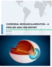 Choroidal Neovascularization - A Pipeline Analysis Report