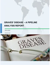 Graves Disease - A Pipeline Analysis Report
