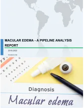 Macular Edema - A Pipeline Analysis Report