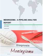 Meningioma - A Pipeline Analysis Report