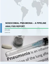 Nosocomial Pneumonia - A Pipeline Analysis Report