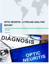 Optic Neuritis - A Pipeline Analysis Report