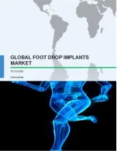 Global Foot Drop Implants Market 2016-2020