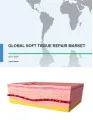 Global Soft Tissue Repair Market 2017-2021
