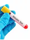 Bilirubin Blood Test Market Analysis North America, Europe, Asia, Rest of World (ROW) - US, Germany, UK, France, China - Size and Forecast 2024-2028