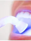 Teeth Whitening Market Analysis APAC, North America, Europe, South America, Middle East and Africa - US, China, India, UK, Germany - Size and Forecast 2023-2027