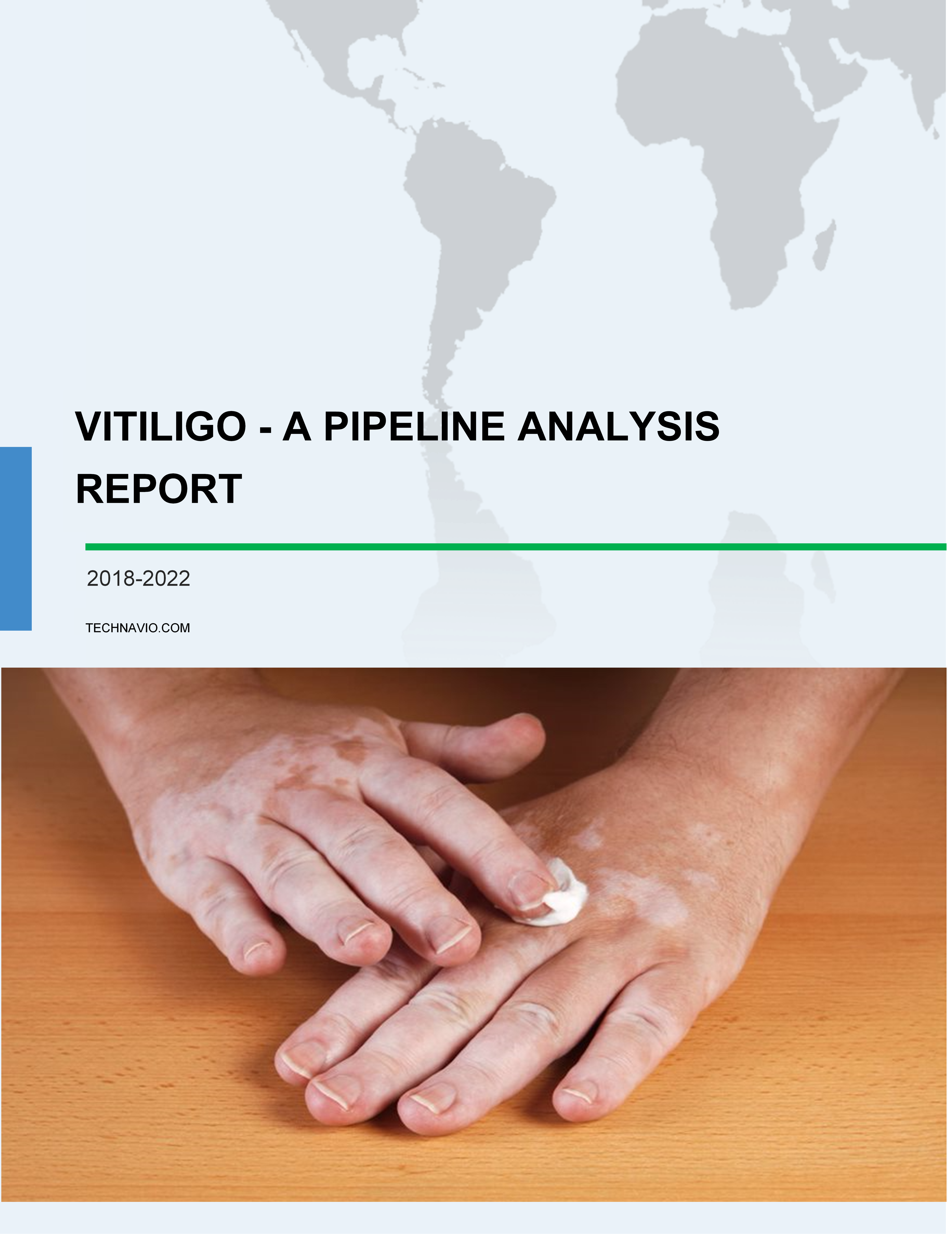 Vitiligo - A Pipeline Analysis Report