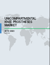 Unicompartmental Knee Prostheses Market by Product and Geography - Global Forecast 2019-2023