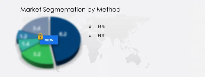 Hair Transplant Market Segmentation