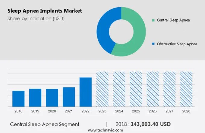 France Sleep Apnea Diagnostic Systems Market Sleep Apnea Implants Market Analysis - US, Germany, France, China